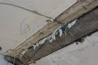 Dilatasyon Bölgesinde Negatif Yönden Enjeksiyon Uygulaması